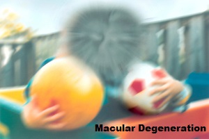 Macular Degeneration Vision